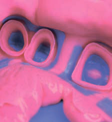 Hydrorise Putty - оттиск